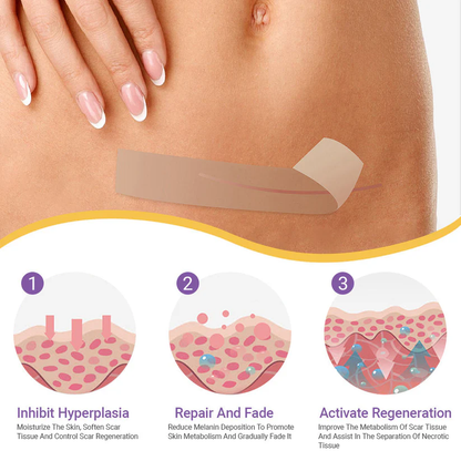 Fivfivgo® Hyaluronic Acid Nano Microneedle Repair Tape (Treatment of old and new scars, reduction of surgical scars, stretch marks, keloids, acne, burns, warts, dermatomes and varicose veins)