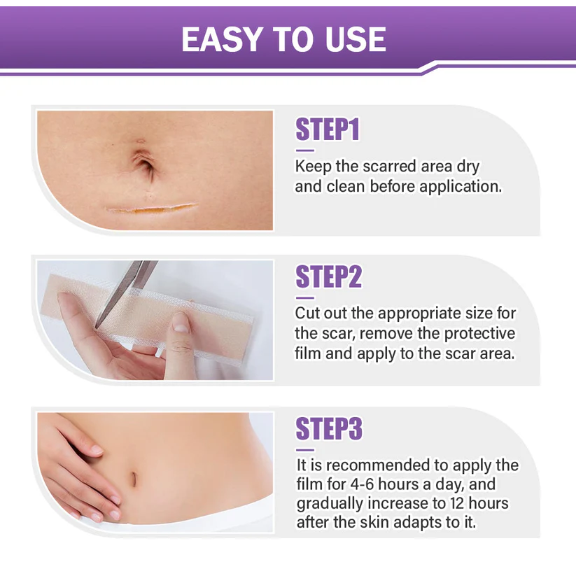 Fivfivgo® Hyaluronic Acid Nano Microneedle Repair Tape (Treatment of old and new scars, reduction of surgical scars, stretch marks, keloids, acne, burns, warts, dermatomes and varicose veins)