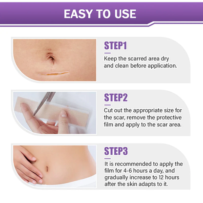 Fivfivgo® Hyaluronic Acid Nano Microneedle Repair Tape (Treatment of old and new scars, reduction of surgical scars, stretch marks, keloids, acne, burns, warts, dermatomes and varicose veins)