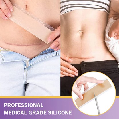 Fivfivgo® Hyaluronic Acid Nano Microneedle Repair Tape (Treatment of old and new scars, reduction of surgical scars, stretch marks, keloids, acne, burns, warts, dermatomes and varicose veins)