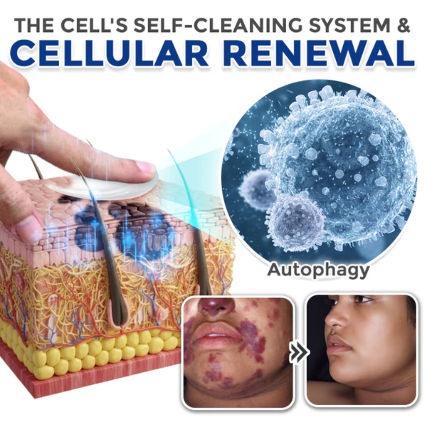 Fivfivgo® Spermidine Autophagy Comprehensive Cream (Treats Skin Tags, Warts, Eczema, Pigmentation, Keratosis)