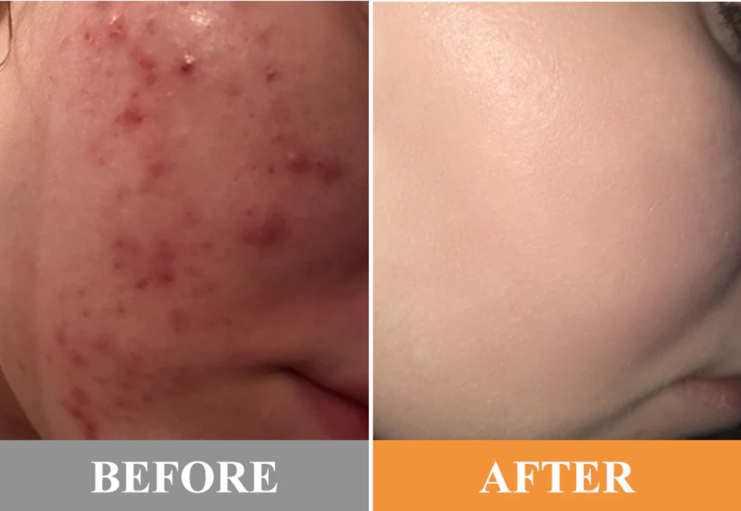 Fivfivgo® Exfoliating Brightening Gel image Fivfivgo® Exfoliating Brightening Gel