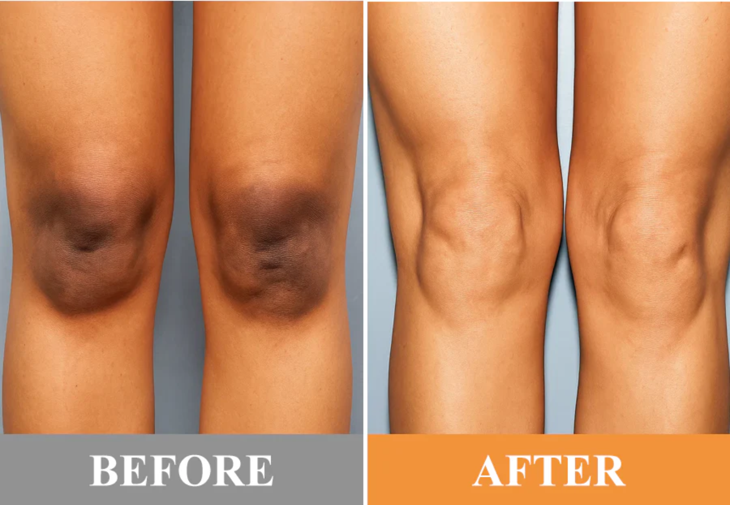 Fivfivgo® Exfoliating Brightening Gel image Fivfivgo® Exfoliating Brightening Gel