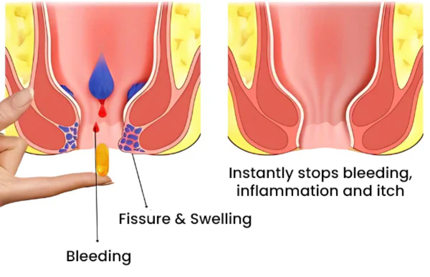 Récupération tissulaire