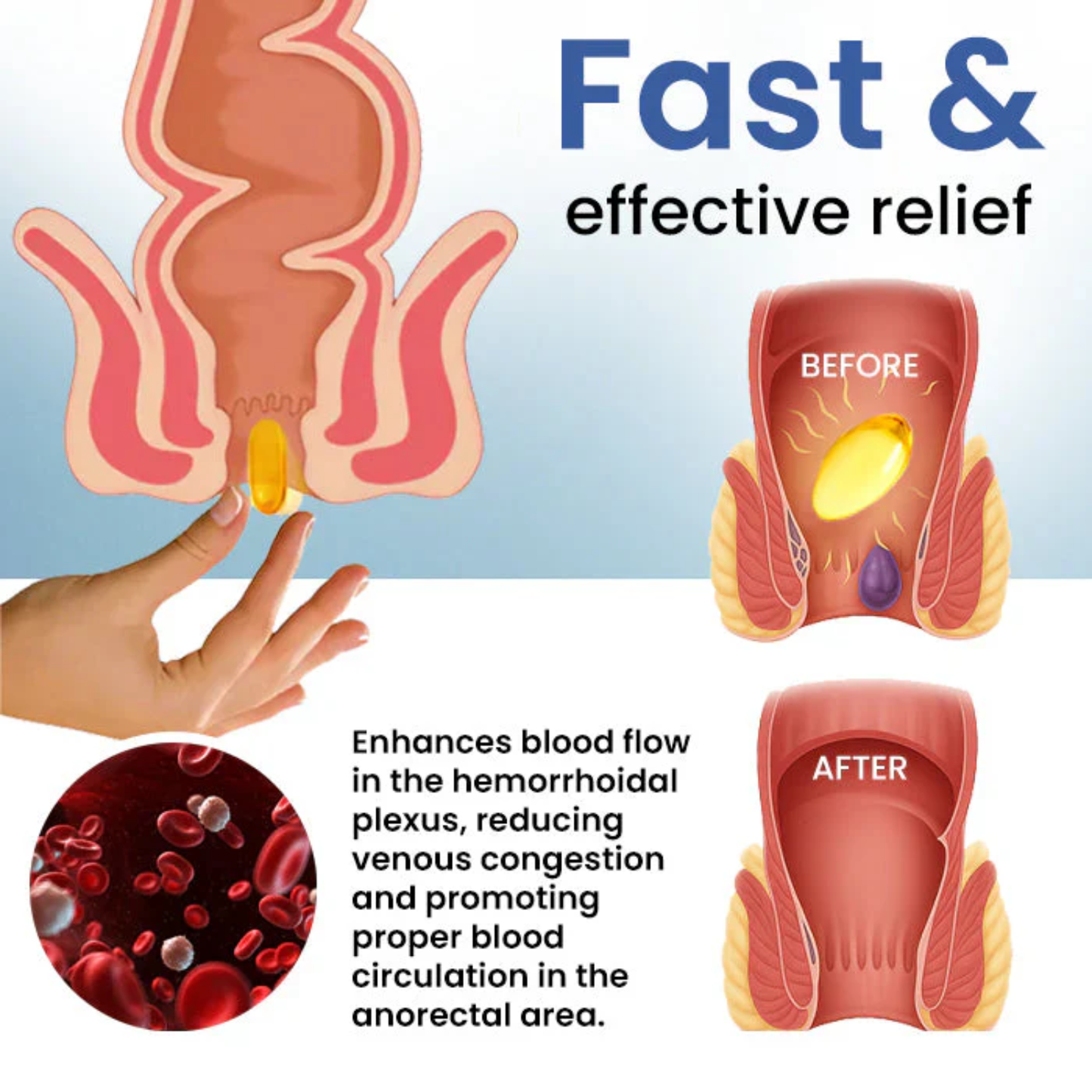 Fivfivgo® Natural Hemorrhoid Capsules