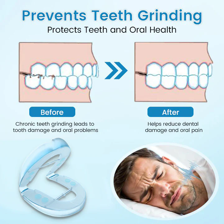 Bikenda® DreamGuard Anti-Snoring & Teeth Grinding Teeth Protector