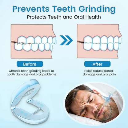 Bikenda® DreamGuard Anti-Snoring & Teeth Grinding Teeth Protector