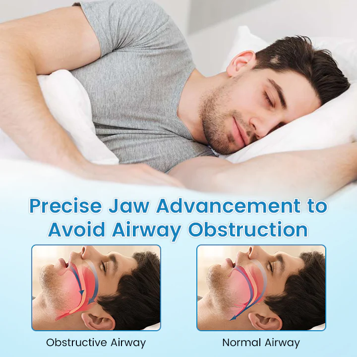 Bikenda® DreamGuard Anti-Snoring & Teeth Grinding Teeth Protector