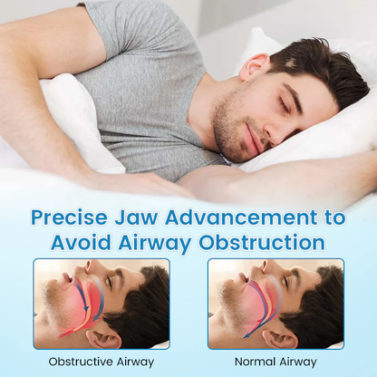 Bikenda® DreamGuard Anti-Snoring & Teeth Grinding Teeth Protector