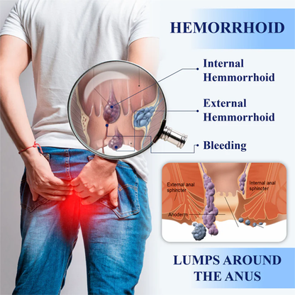 Fivfivgo® Hemorrhoid Treatment Gel
