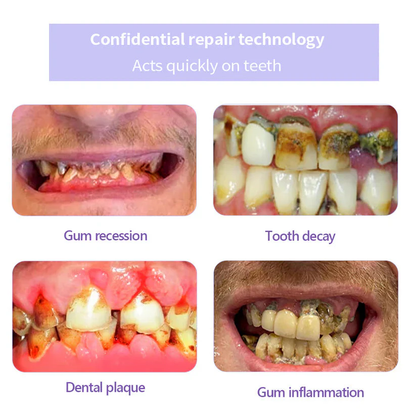 Fivfivgo® Teeth Restoration Mineral Powder