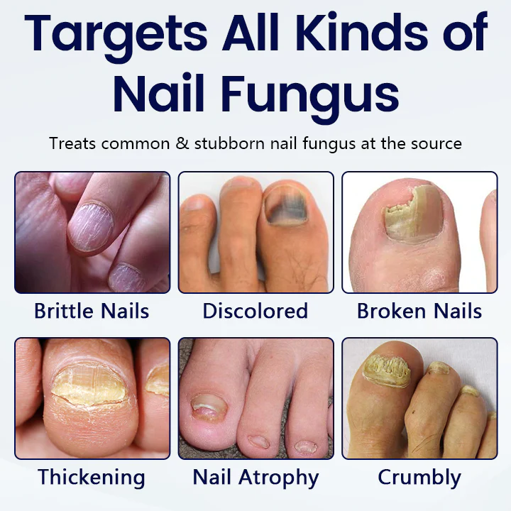 Fivfivgo® Anti-Fungal Nail Repair Patch