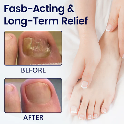 Fivfivgo® Anti-Fungal Nail Repair Patch