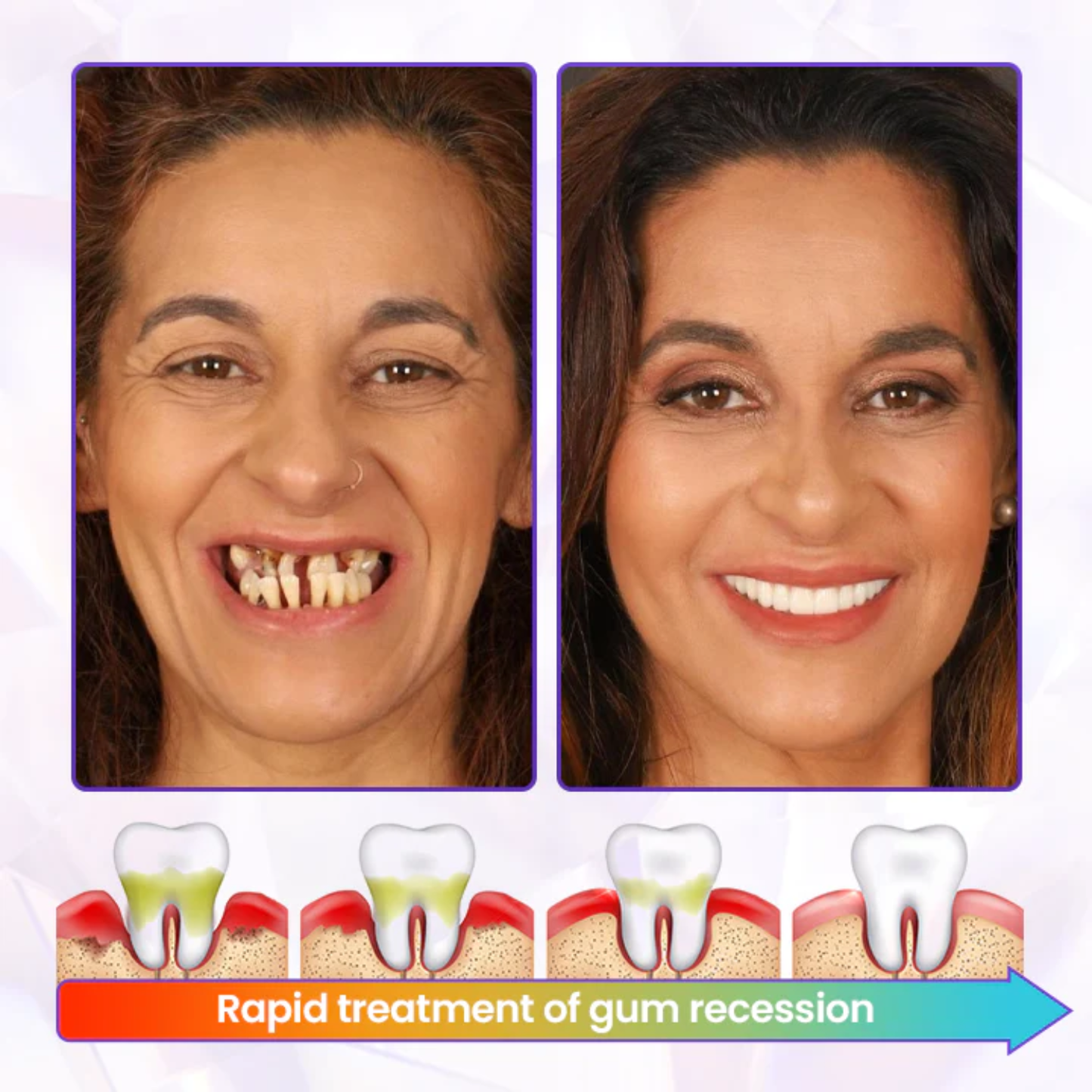 Fivfivgo® BeeRenew Advanced Gum Healing Toothpaste