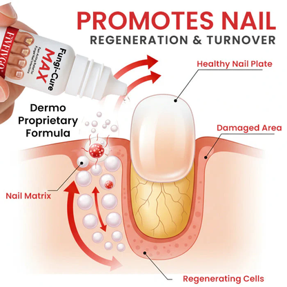 Fivfivgo® Fungi-Cure Max – Fast-Acting Relief for Fungal Nail Infections