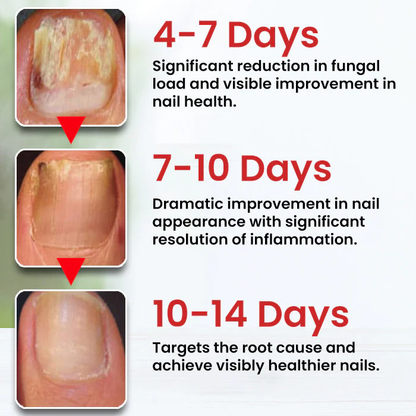 Fivfivgo® Fungi-Cure Max – Fast-Acting Relief for Fungal Nail Infections