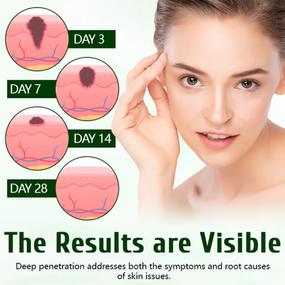 Fivfivgo® DermaPure Tea Tree Healing Cream
