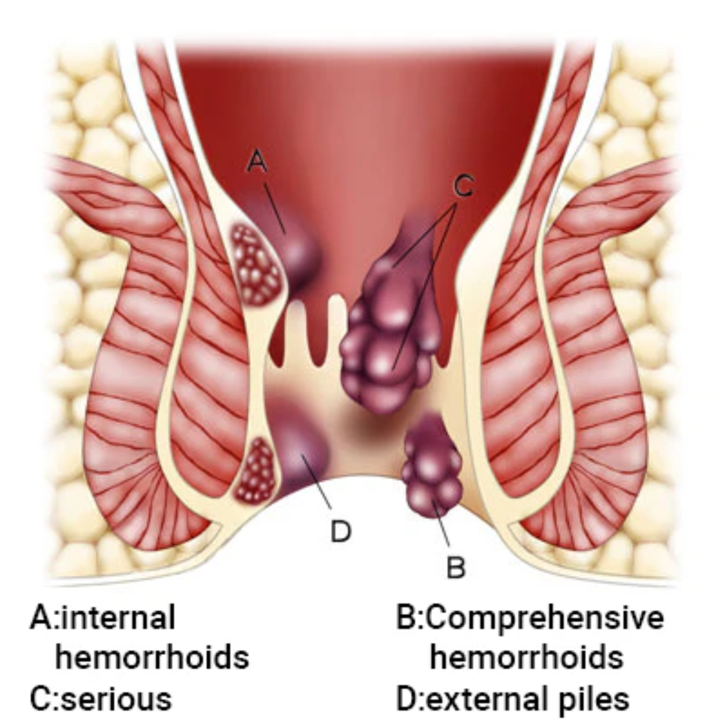 Fivfivgo® Fast Hemorrhoid Spray