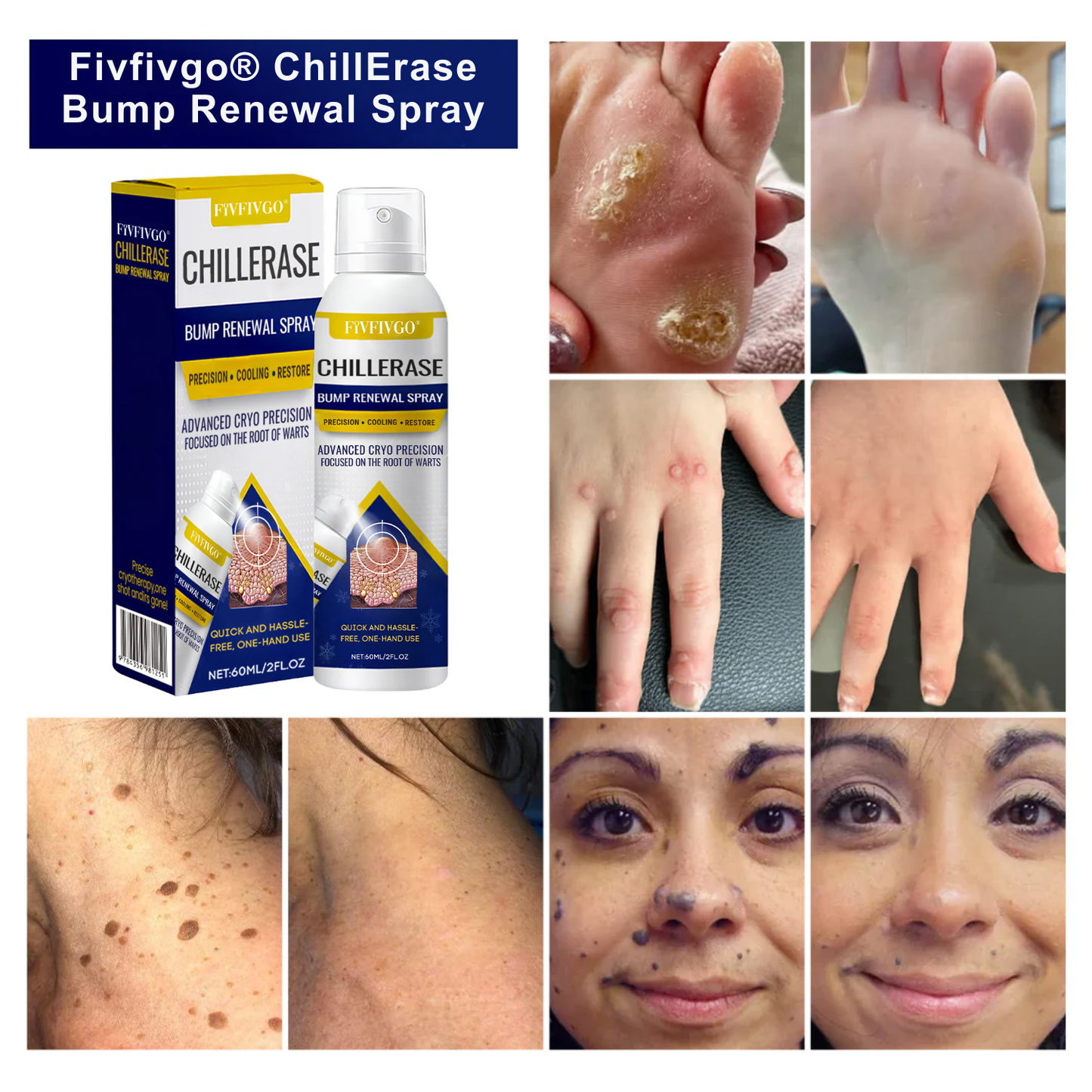 Fivfivgo® ChillErase Bump Renewal Spray