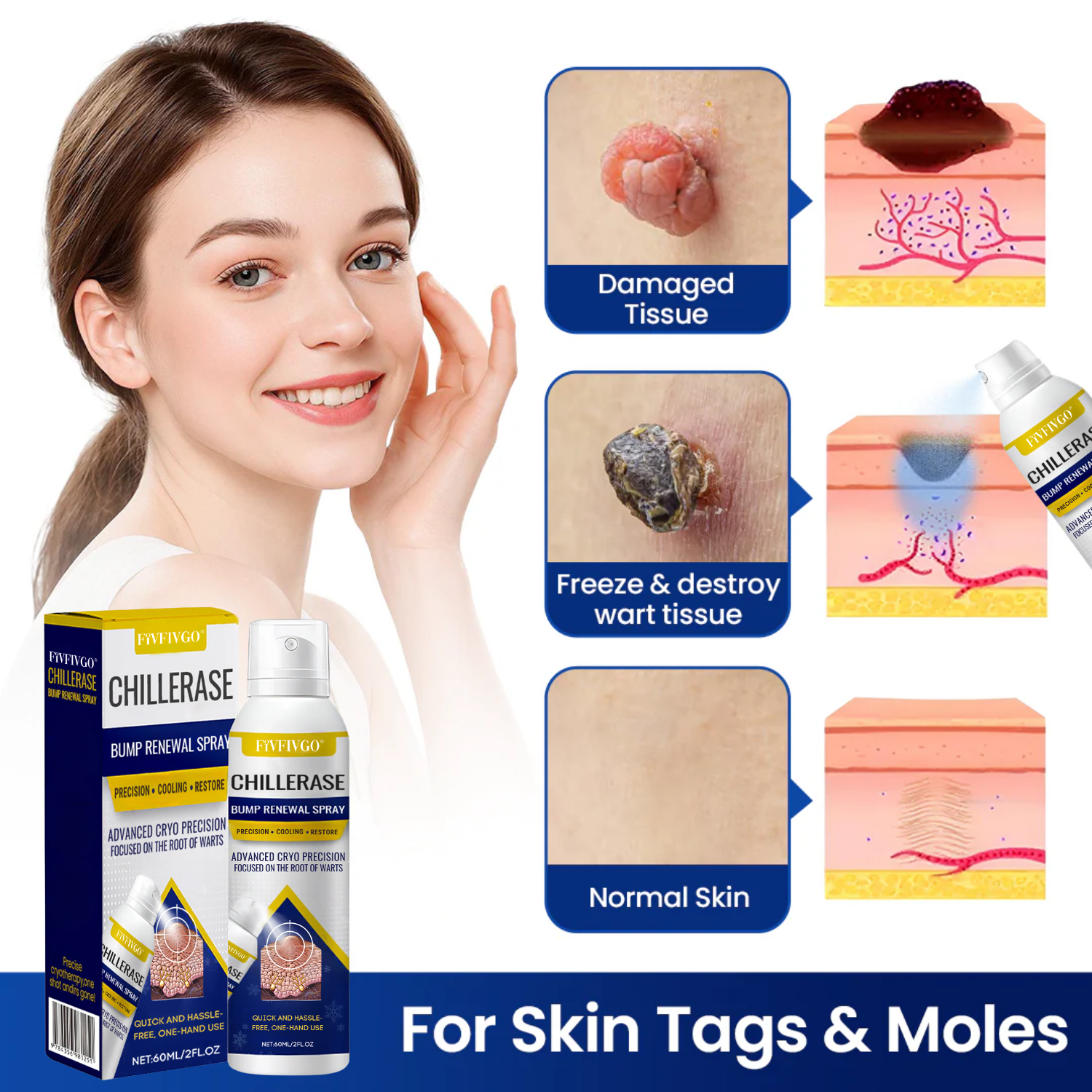 Fivfivgo® ChillErase Bump Renewal Spray image Fivfivgo® ChillErase Bump Renewal Spray