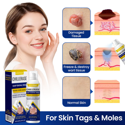 Fivfivgo® ChillErase Bump Renewal Spray