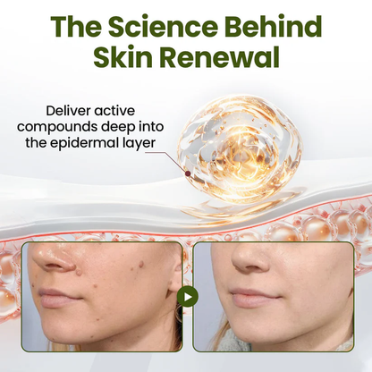 Fivfivgo® MagneErase Renewal Cream