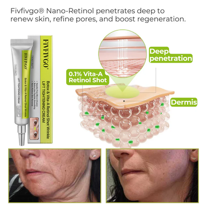 Fivfivgo® Botox & Vita-A Retinol Shot Wrinkle - Lift Tightening Cream