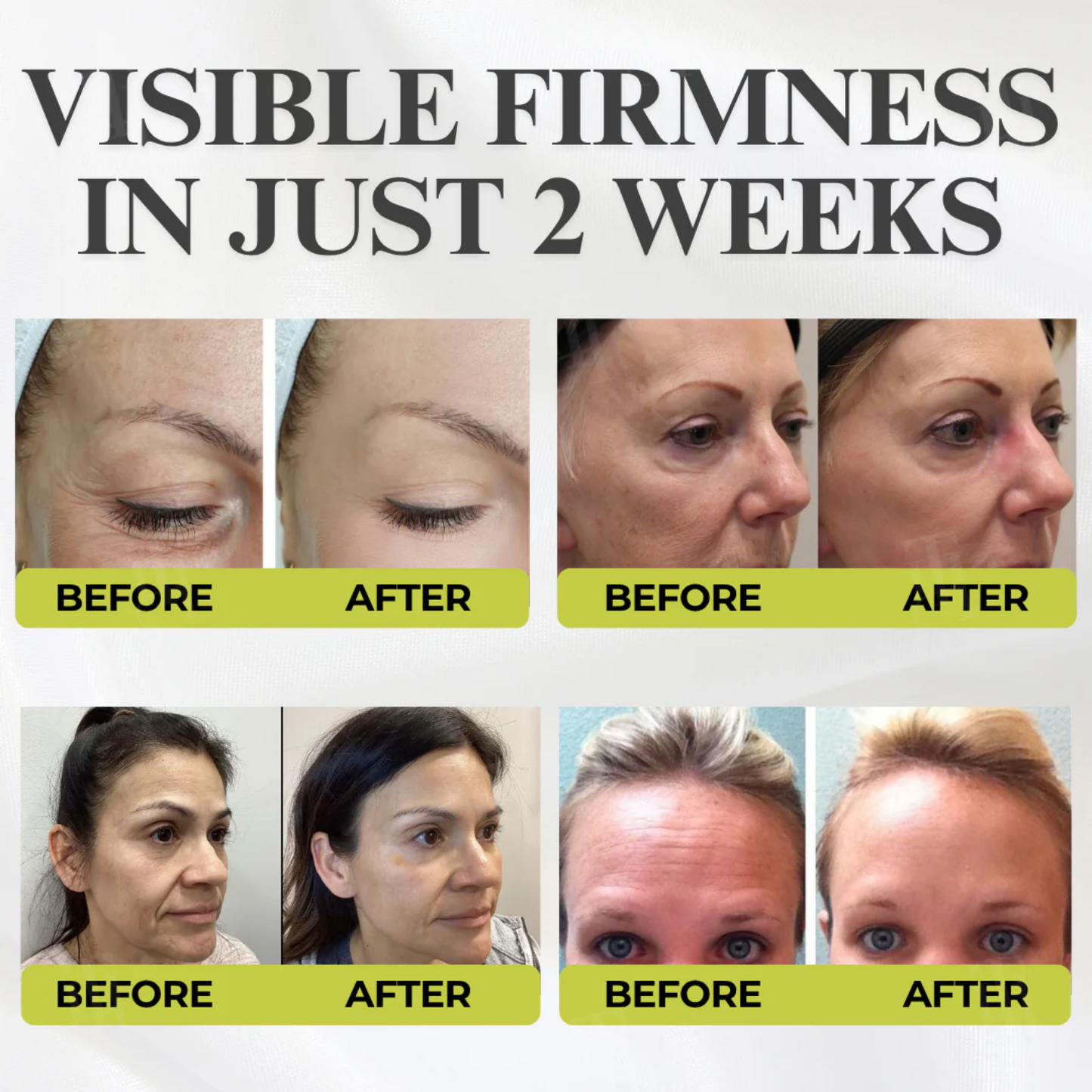 Fivfivgo® Botox & Vita-A Retinol Shot Wrinkle - Lift Tightening Cream