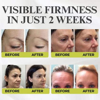 Fivfivgo® Botox & Vita-A Retinol Shot Wrinkle - Lift Tightening Cream