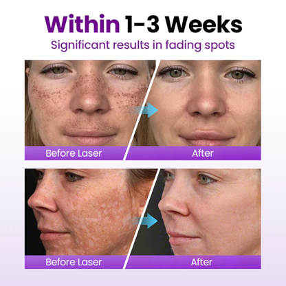 Fivfivgo® SpotErase Probiotic Shield Serum