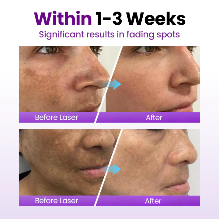 Fivfivgo® SpotErase Probiotic Shield Serum
