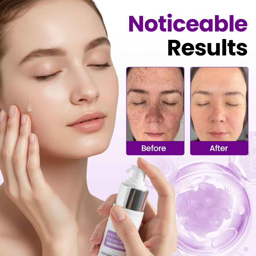 Fivfivgo® SpotErase Probiotic Shield Serum