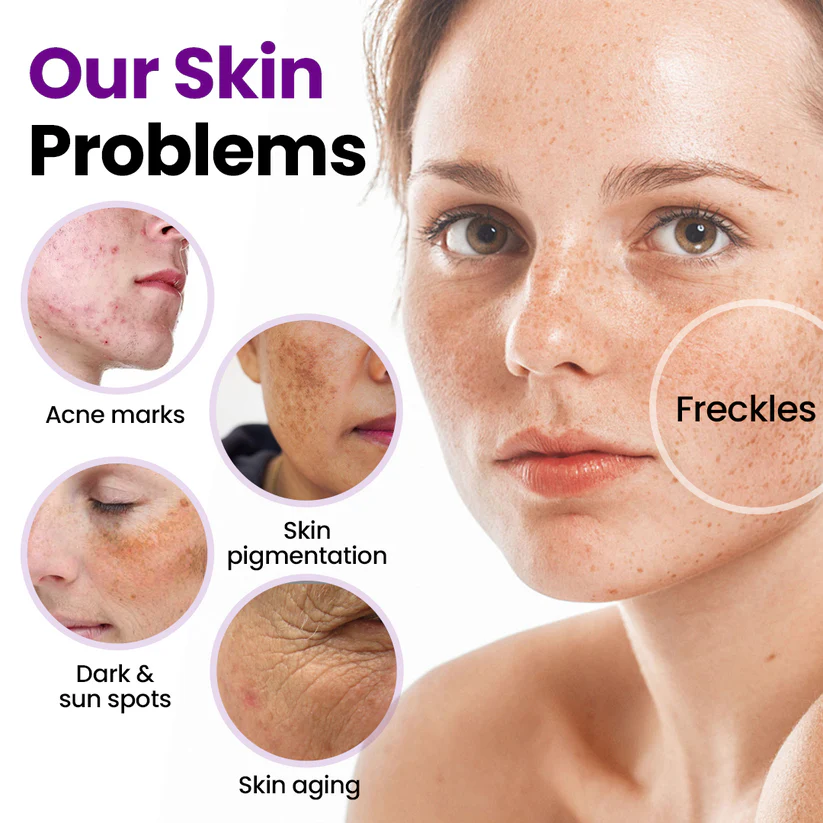 Fivfivgo® SpotErase Probiotic Shield Serum