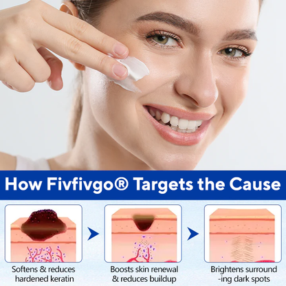 Fivfivgo® WartClear Herbal Ointment