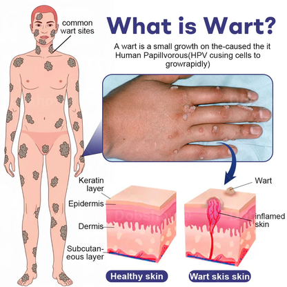 Fivfivgo® Wart Eraser Pro