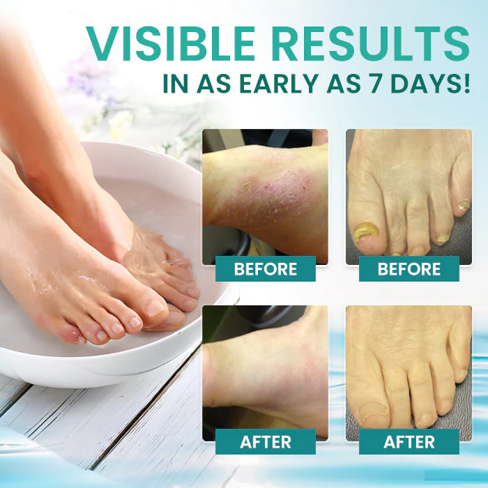 Fivfivgo® ItchBreak Sea Salt Soak