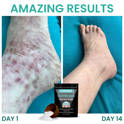 Fivfivgo® ItchBreak Sea Salt Soak