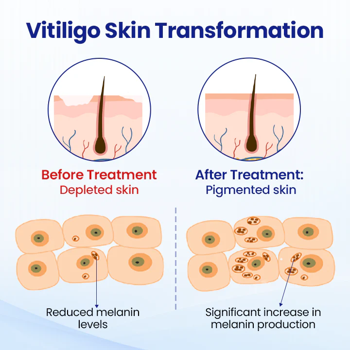 Fivfivgo® VitiClear Herbal Spray