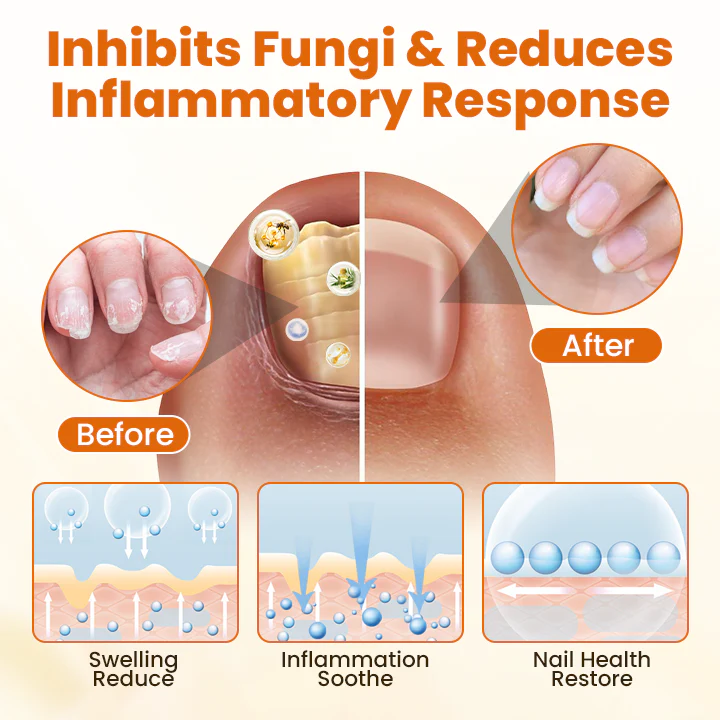 Fivfivgo® FungiBee Advanced Nail Repair Spray