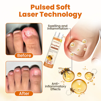 Fivfivgo® FungiBee Advanced Nail Repair Spray