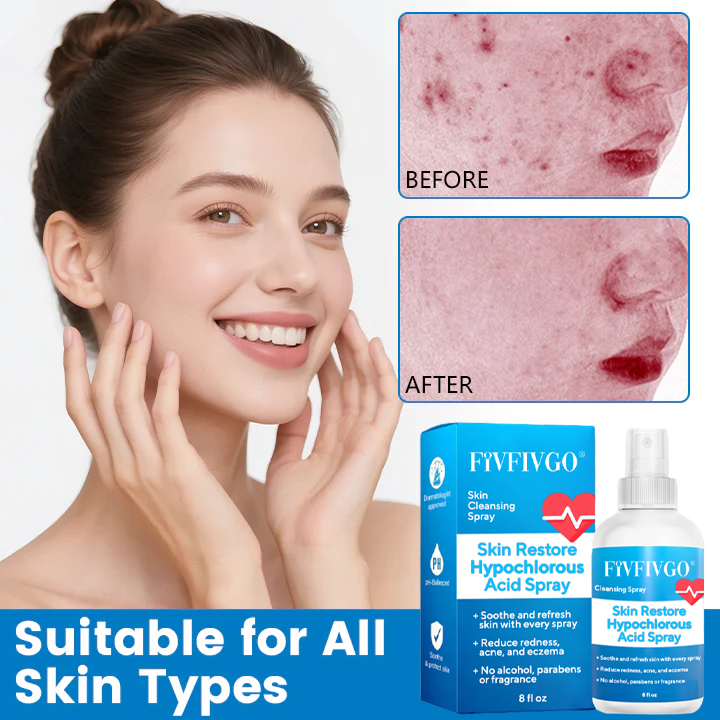 Fivfivgo® Skin Restore Hypochlorous Acid Spray image Fivfivgo® Skin Restore Hypochlorous Acid Spray