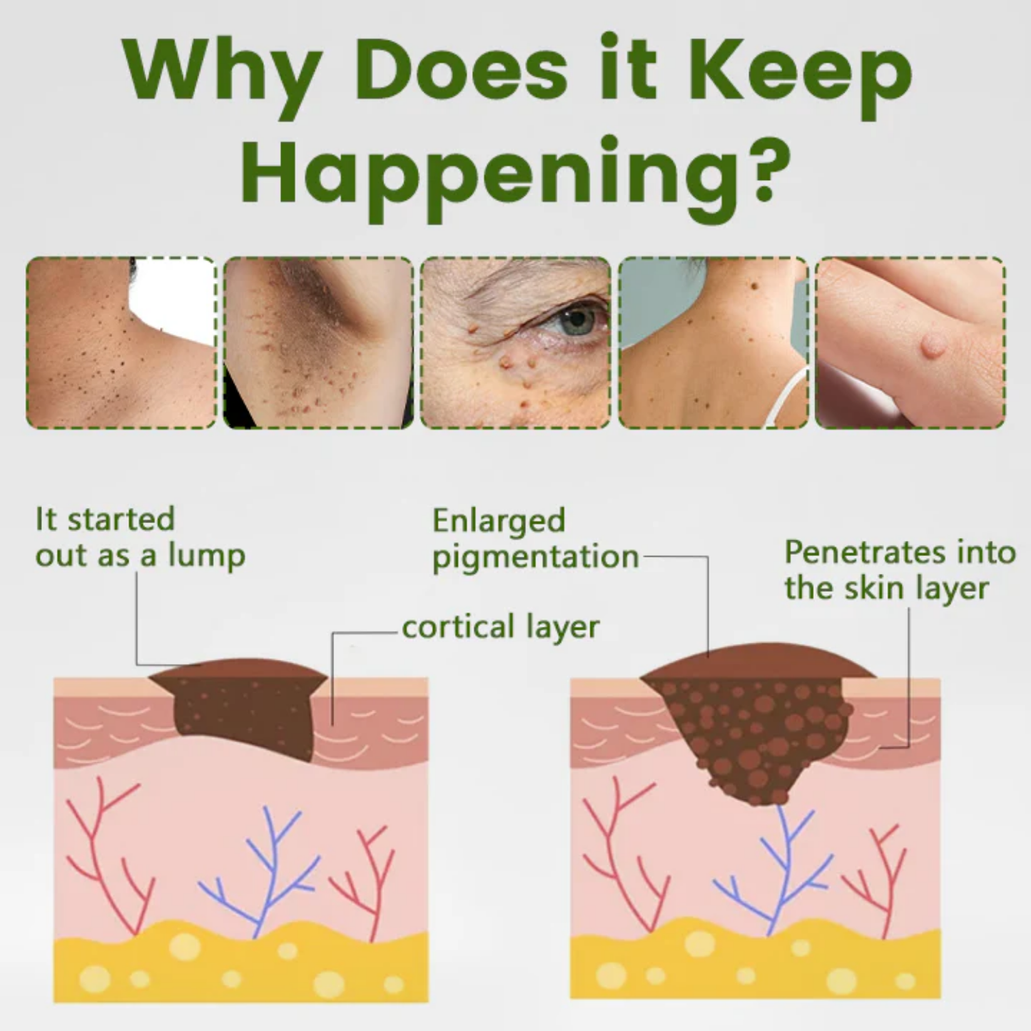 Fivfivgo® ThujaClear Botanical Wart Cream