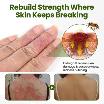 Fivfivgo® BeePeptide RootSoft DualRelief Cream