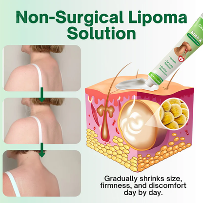 Cvreoz® Knot-X Lipoma Dissolve Cream