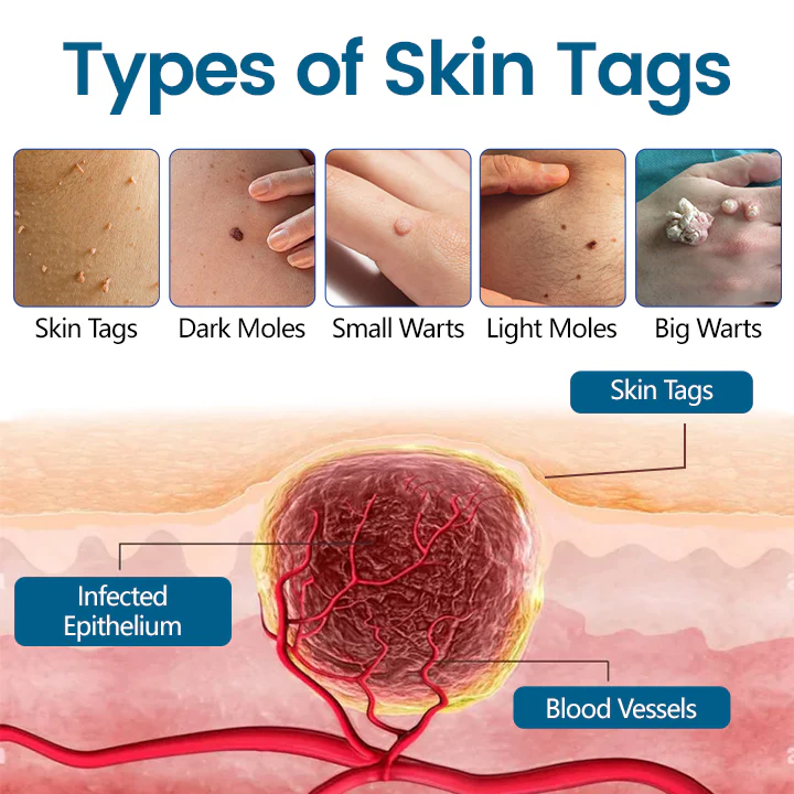 Fivfivgo® DermaVenom RX+ Precision Removal Cream