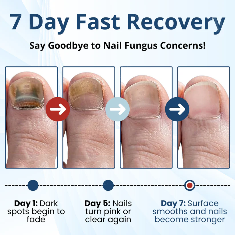 Fivfivgo® MycoShield Pro Fungal Nail Patches 🏥 Visible Results In 2 Days + Professional Grade Repair