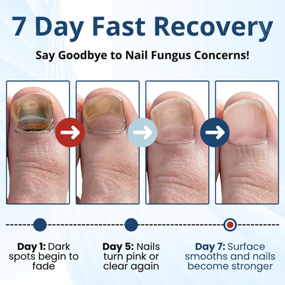 Fivfivgo® MycoShield Pro Fungal Nail Patches 🏥 Visible Results In 2 Days + Professional Grade Repair