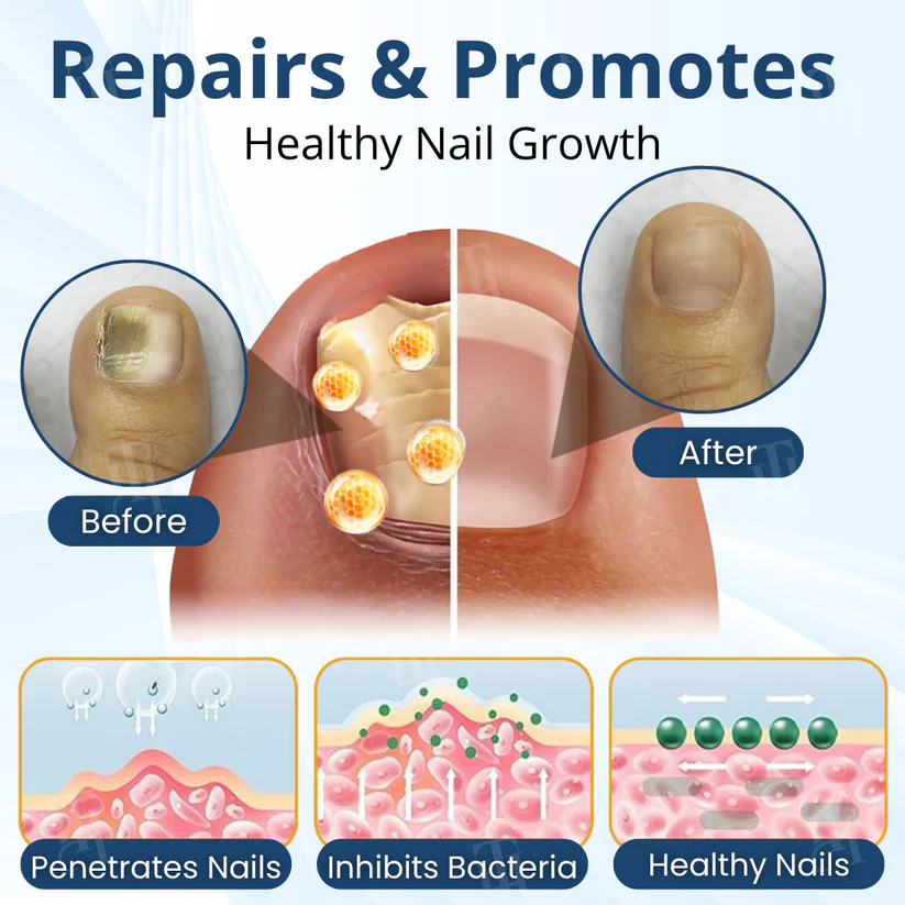 Fivfivgo® MycoShield Pro Fungal Nail Patches 🏥 Visible Results In 2 Days + Professional Grade Repair