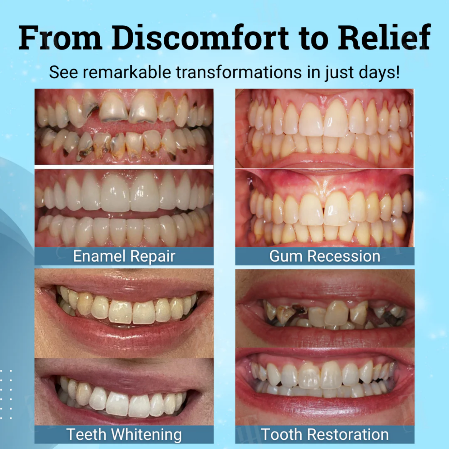 Fivfivgo® Gum Gel