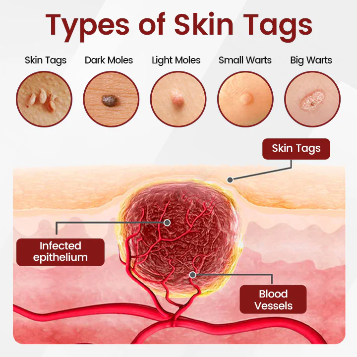 Fivfivgo® KeraErase Black Rice Renewal Ampoule image Fivfivgo® KeraErase Black Rice Renewal Ampoule